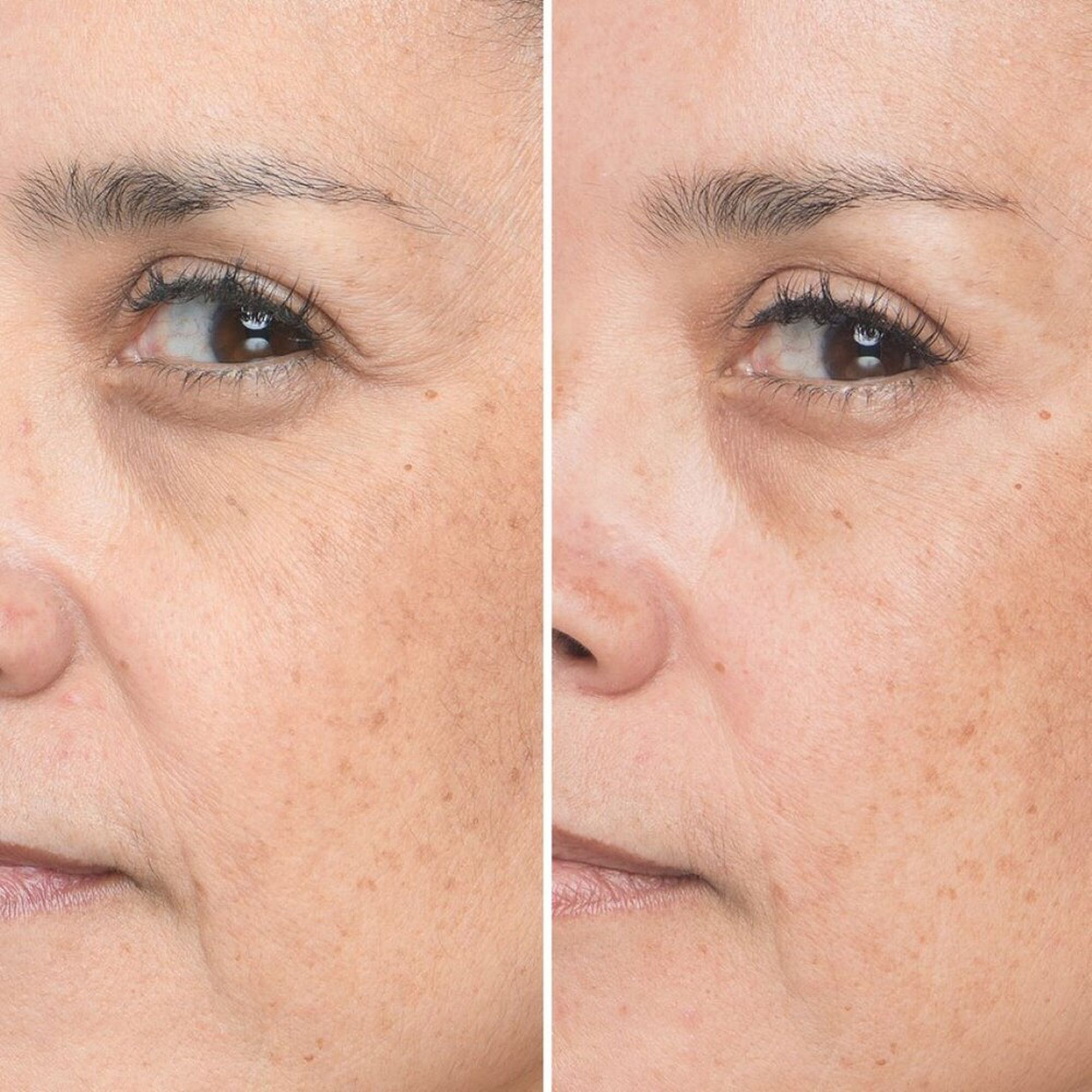 Bye Bye Lines Sérum Concentrated Derma Serum