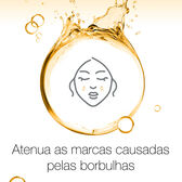 Spot Controlling Hidratante Oil Free Wells Image 3