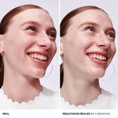 Sérum Rosto Bye Bye Redness Wells Image 2