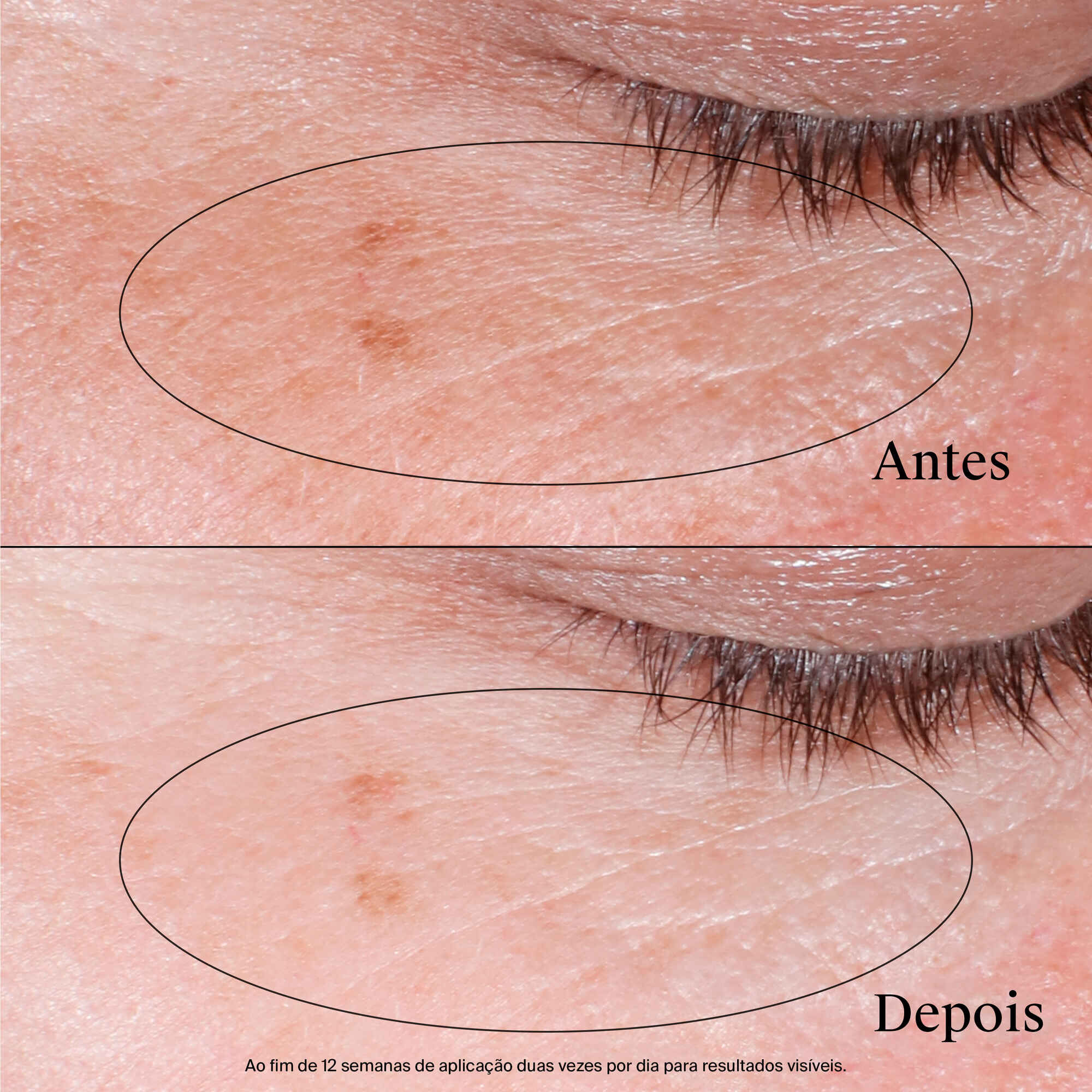 Collagen Bank Contorno Ojos Revitalizante