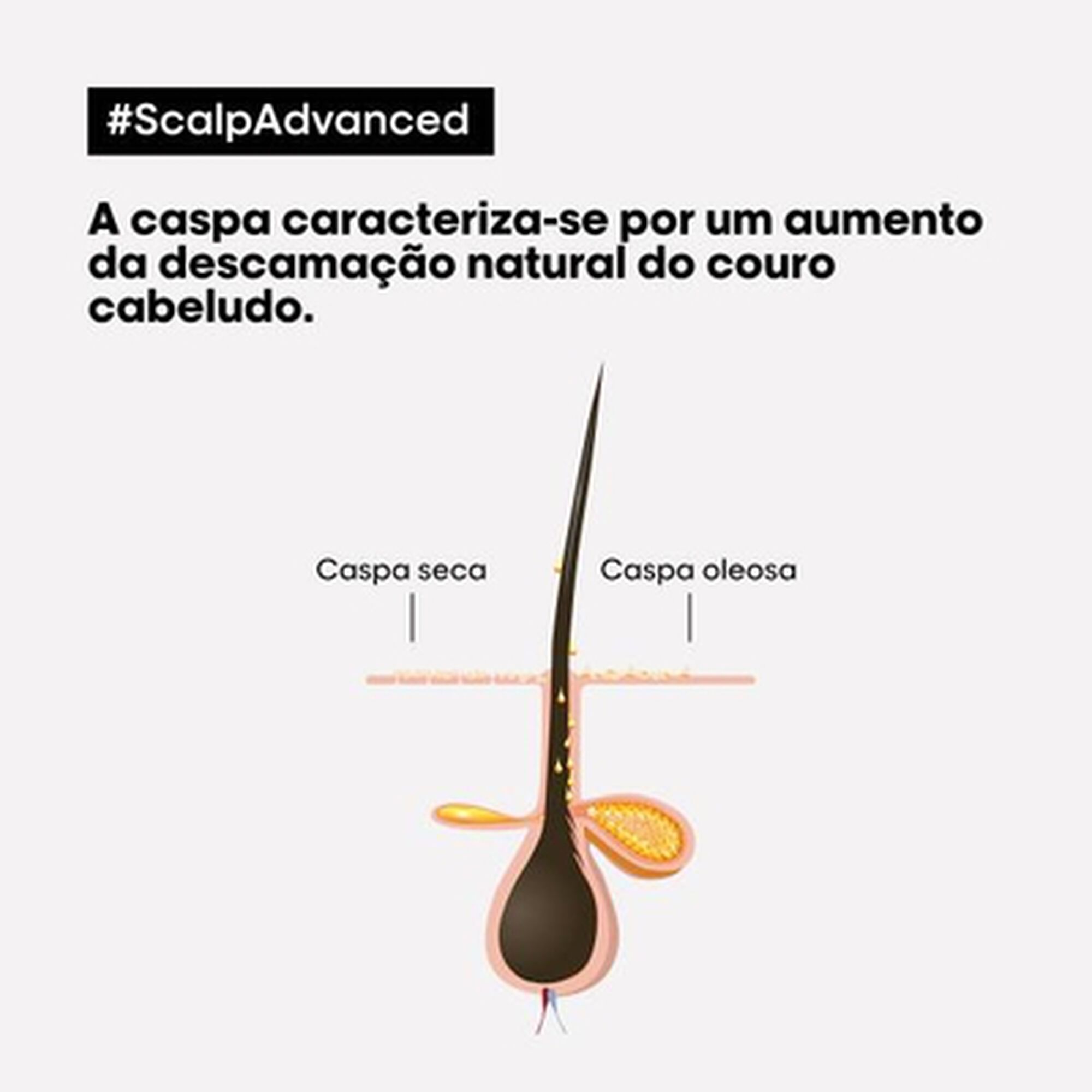 Serie Expert Scalp Advanced Pelliculaire Shampoo