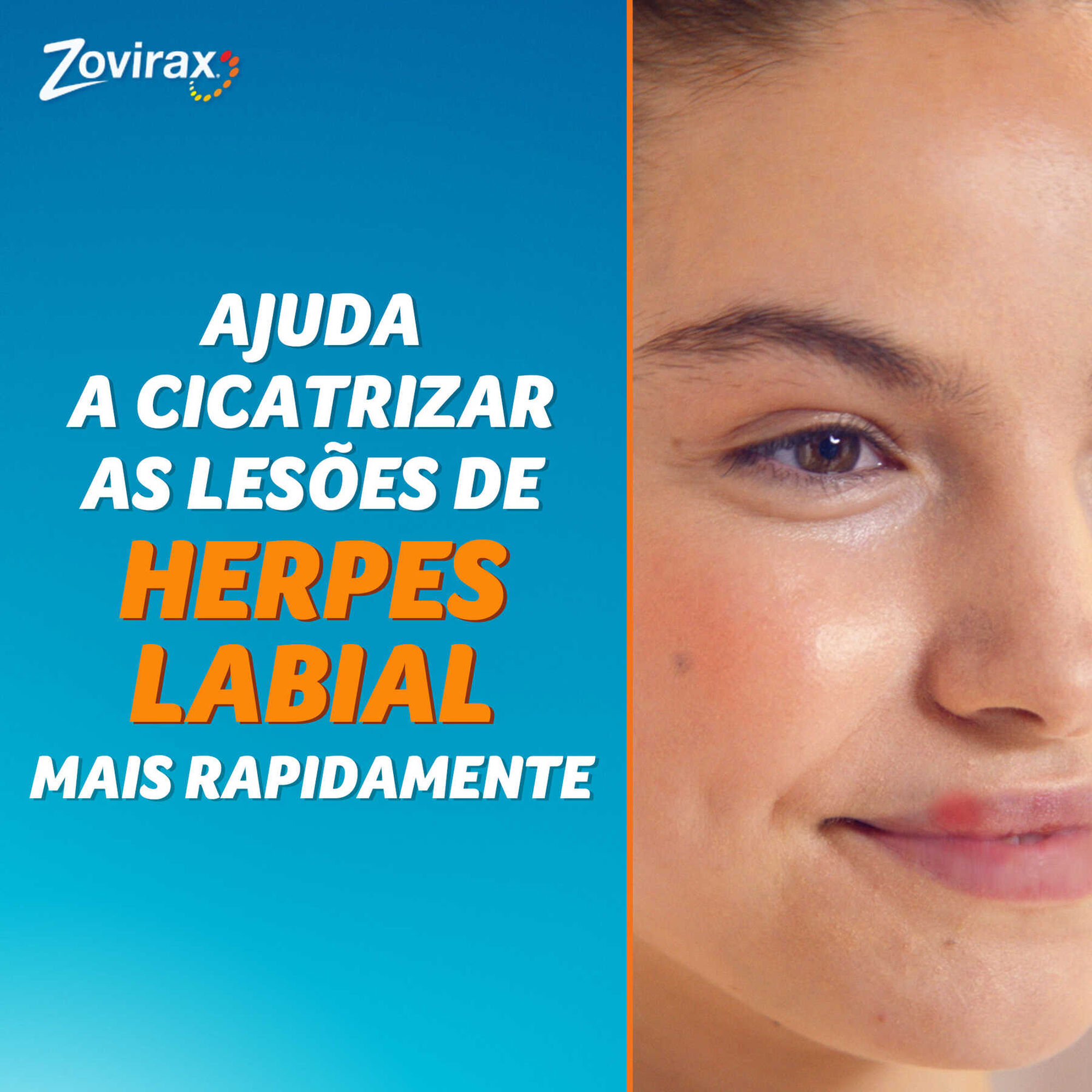 Zovirax Creme Herpes Labial Aciclovir