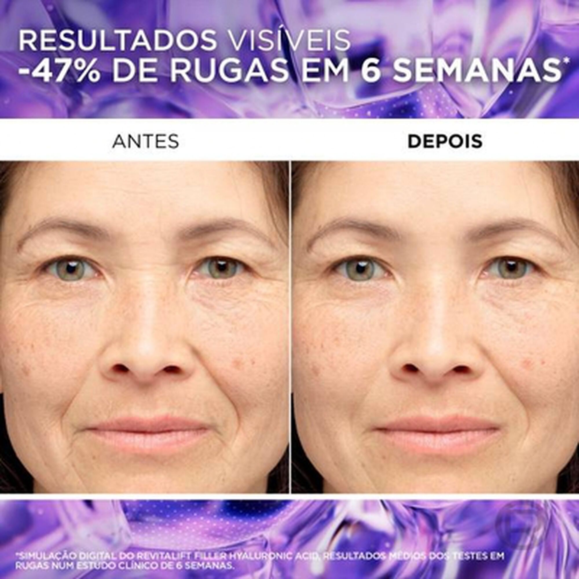 Coffret Revitalift Filler