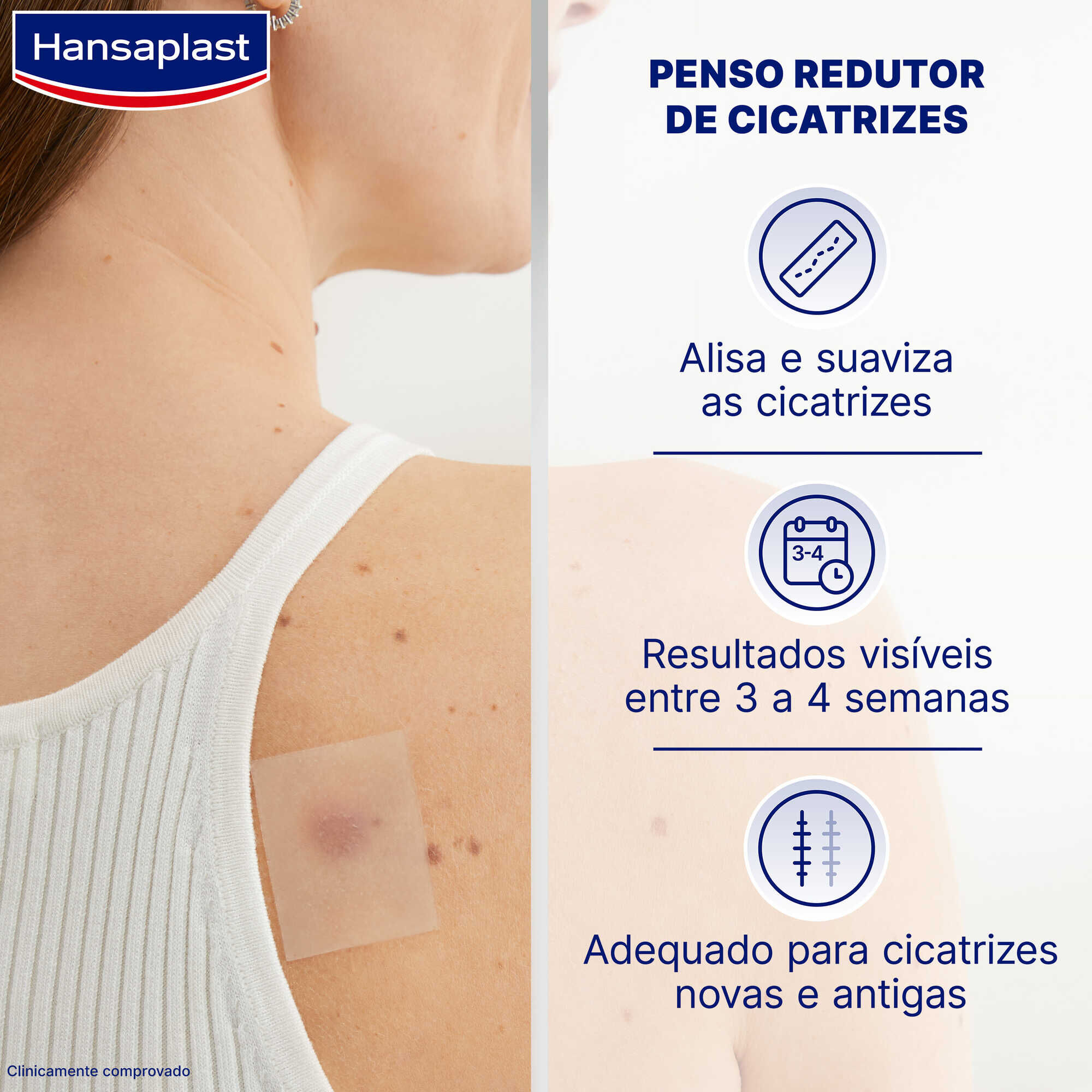 Pensos Redutor de Cicatrizes