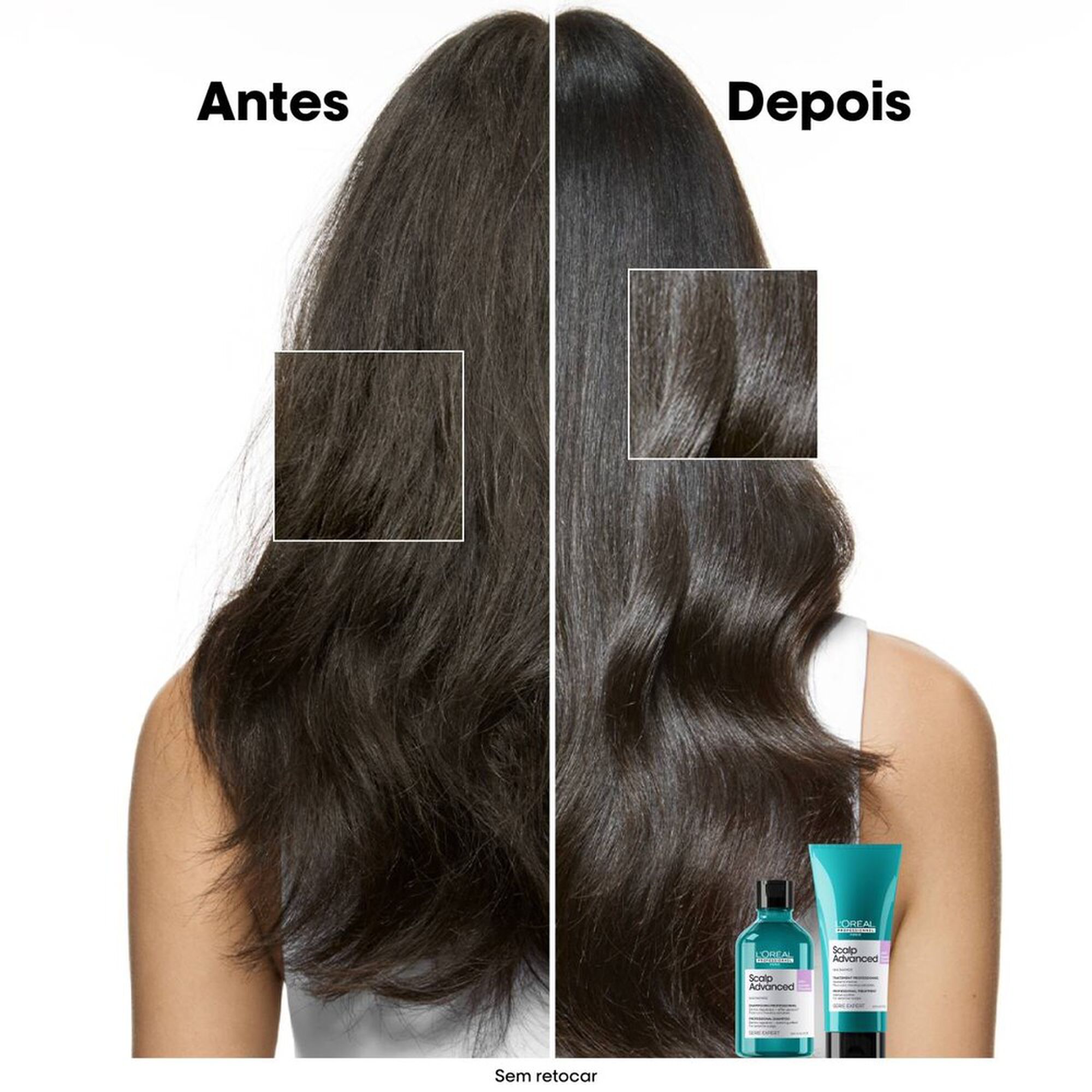 Scalp Advanced Serie Expert Shampoo