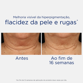 Creme de Pescoço Skin Active Wells Image 5