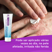 Creme Eczema Sem Cortisona Wells Image 6