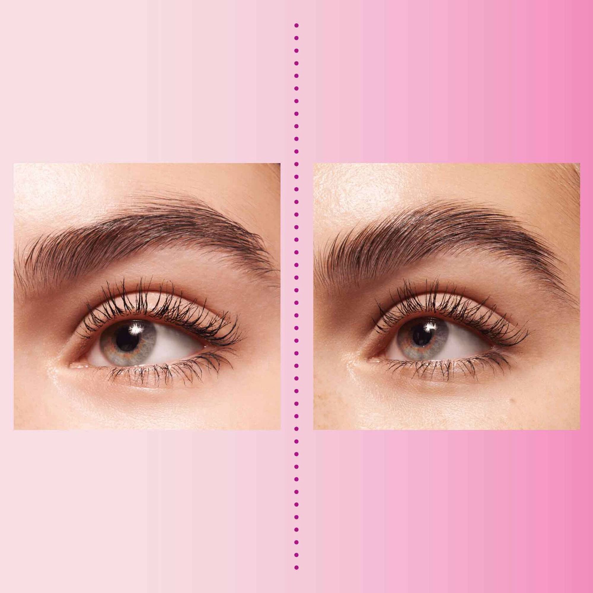 Brow Lifting