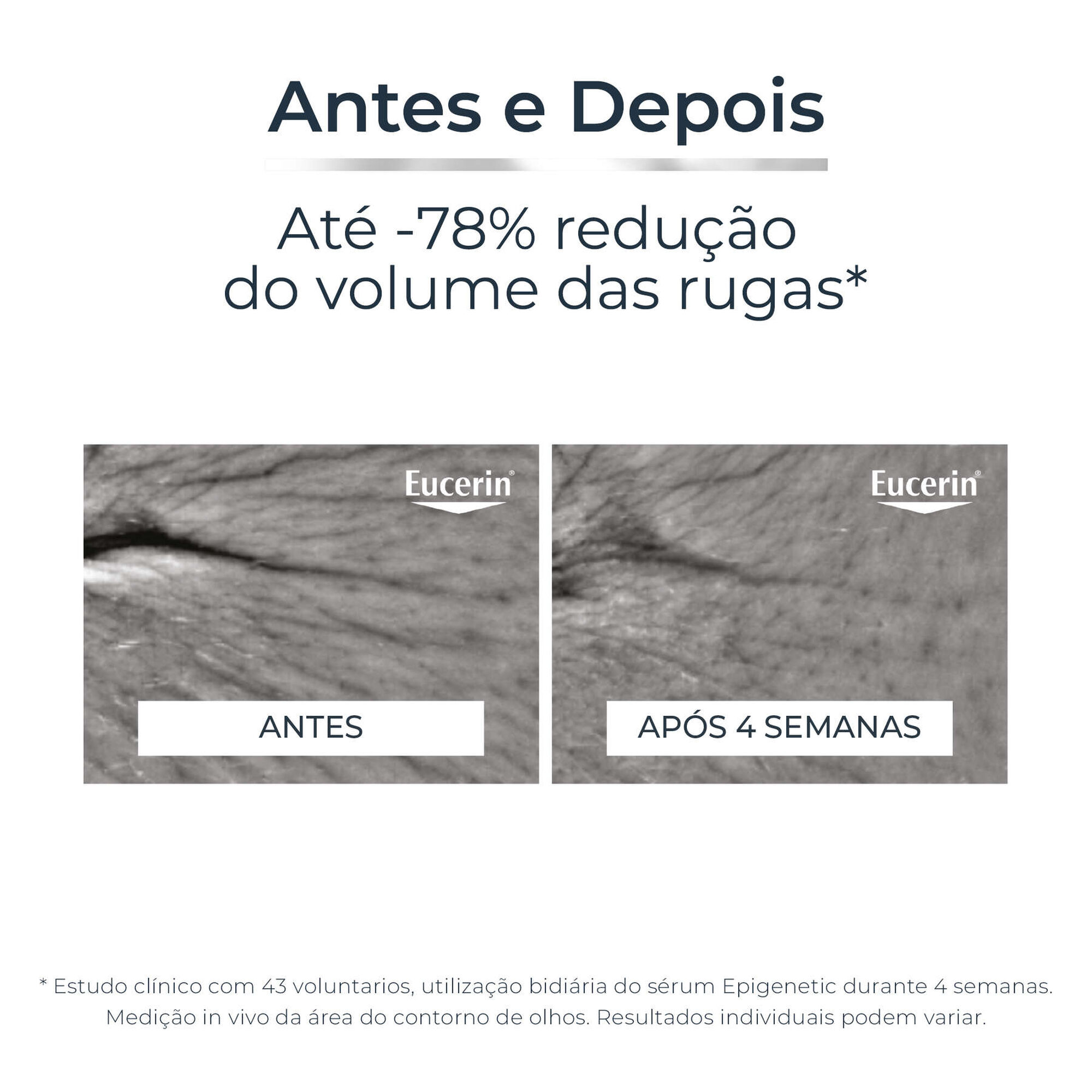 Sérum Rosto Epigenetic Hyaluron-Filler