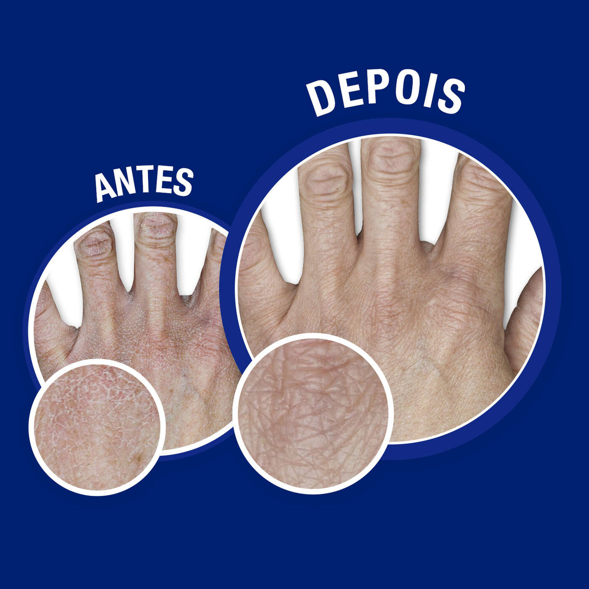 Creme de Mãos Concentrado Com Perfume