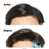 Serie Expert Scalp Advanced Anti-Gras Argile Wells Image 7