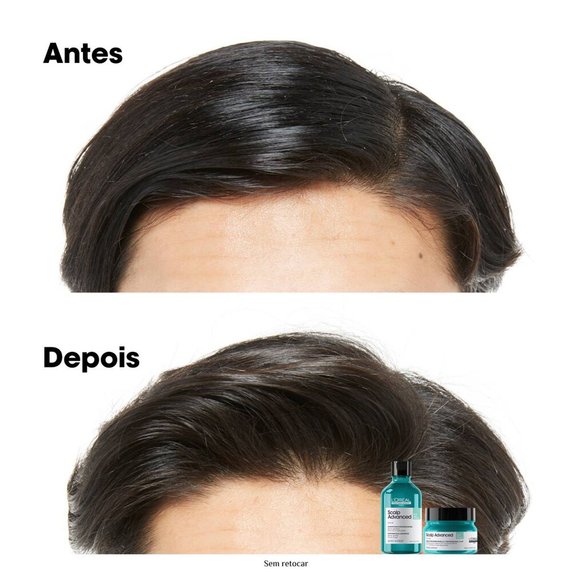 Serie Expert Scalp Advanced Anti-Gras Argile