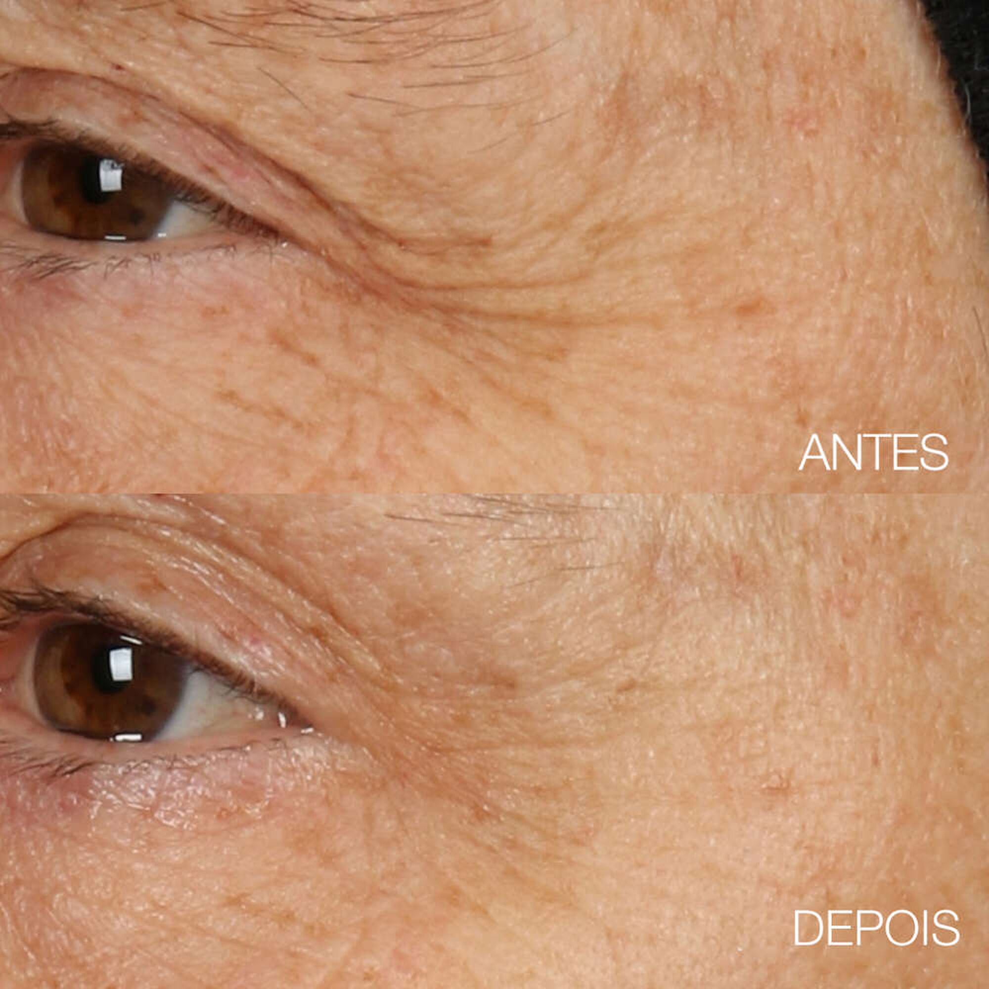 Creme Máscara Rosto Smart Clinical Repair
