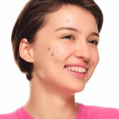 Spot Squad Pimple Patches Wells Image 3