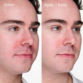 Anti-Blemish Advanced Clearing Gel Wells Image 3