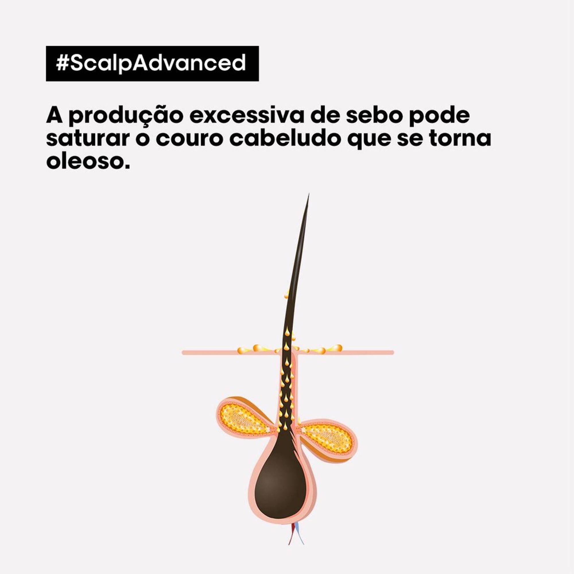 Serie Expert Scalp Advanced Anti-Gras Shampoo