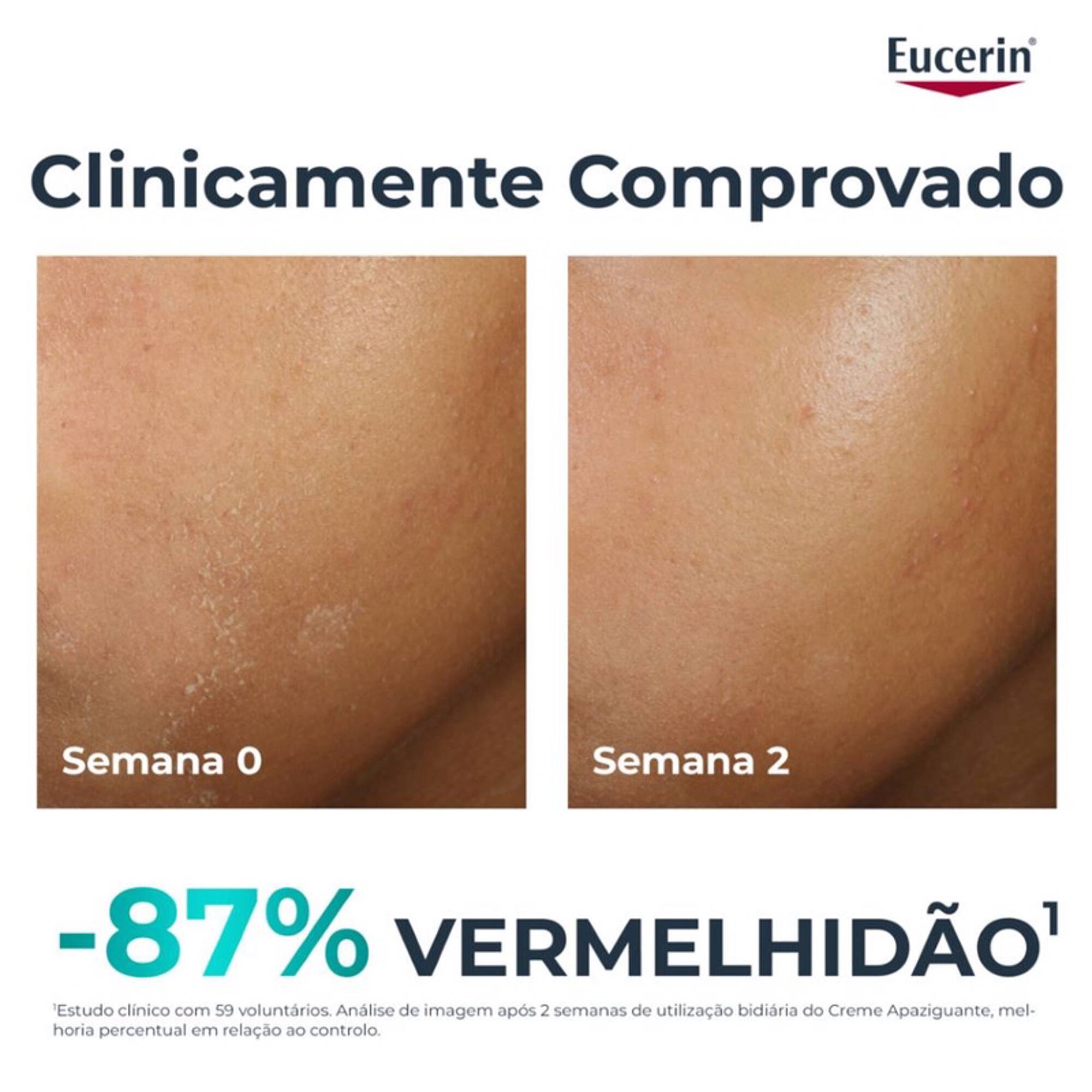 Creme Apaziguante Pele Acneica DermoPure