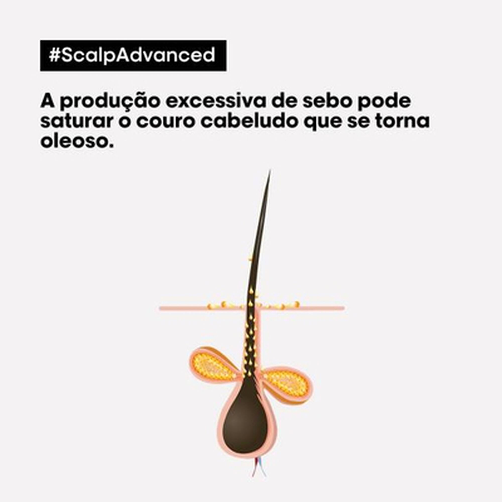 Serie Expert Scalp Advanced Pelliculaire Shampoo