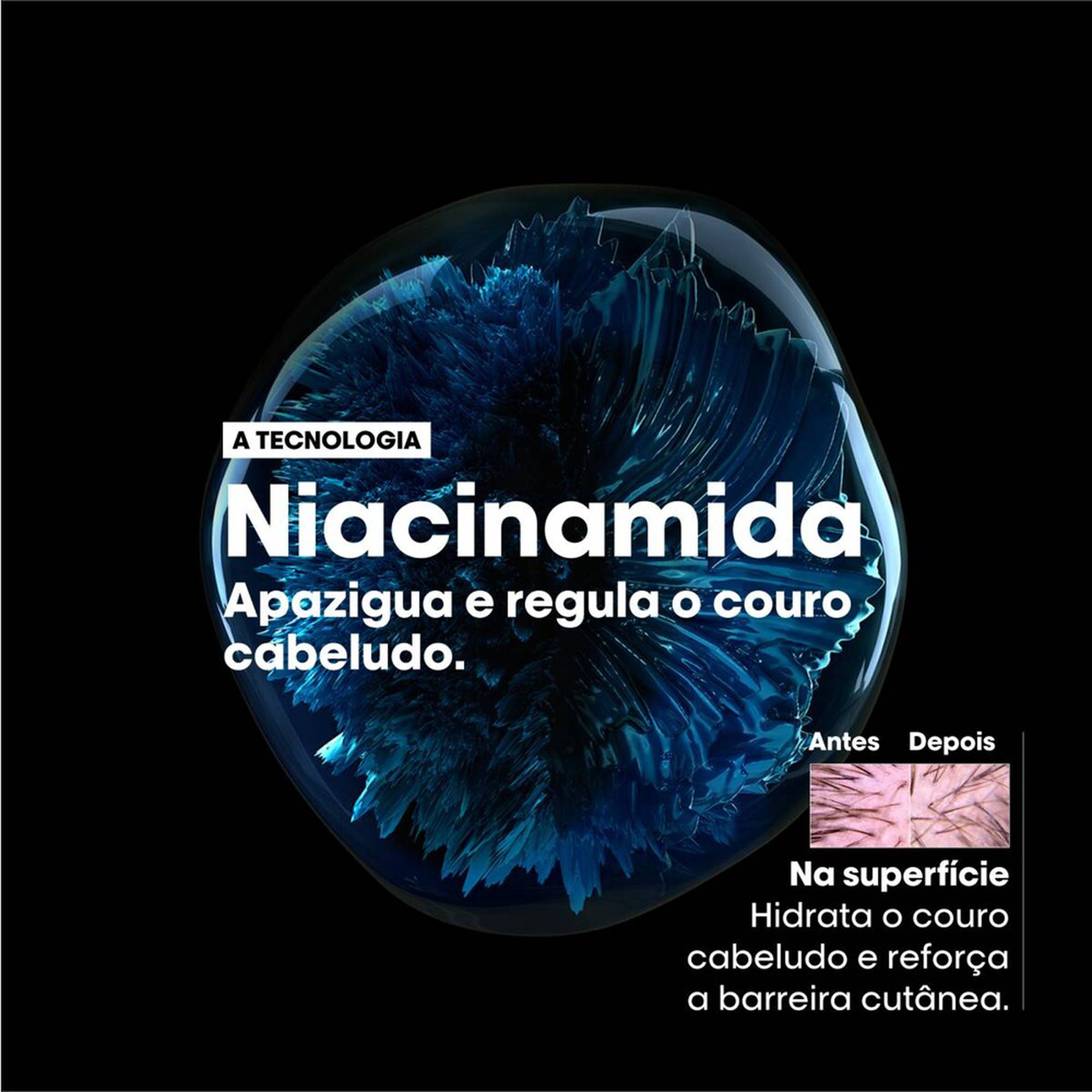 Scalp Advanced Serie Expert Shampoo