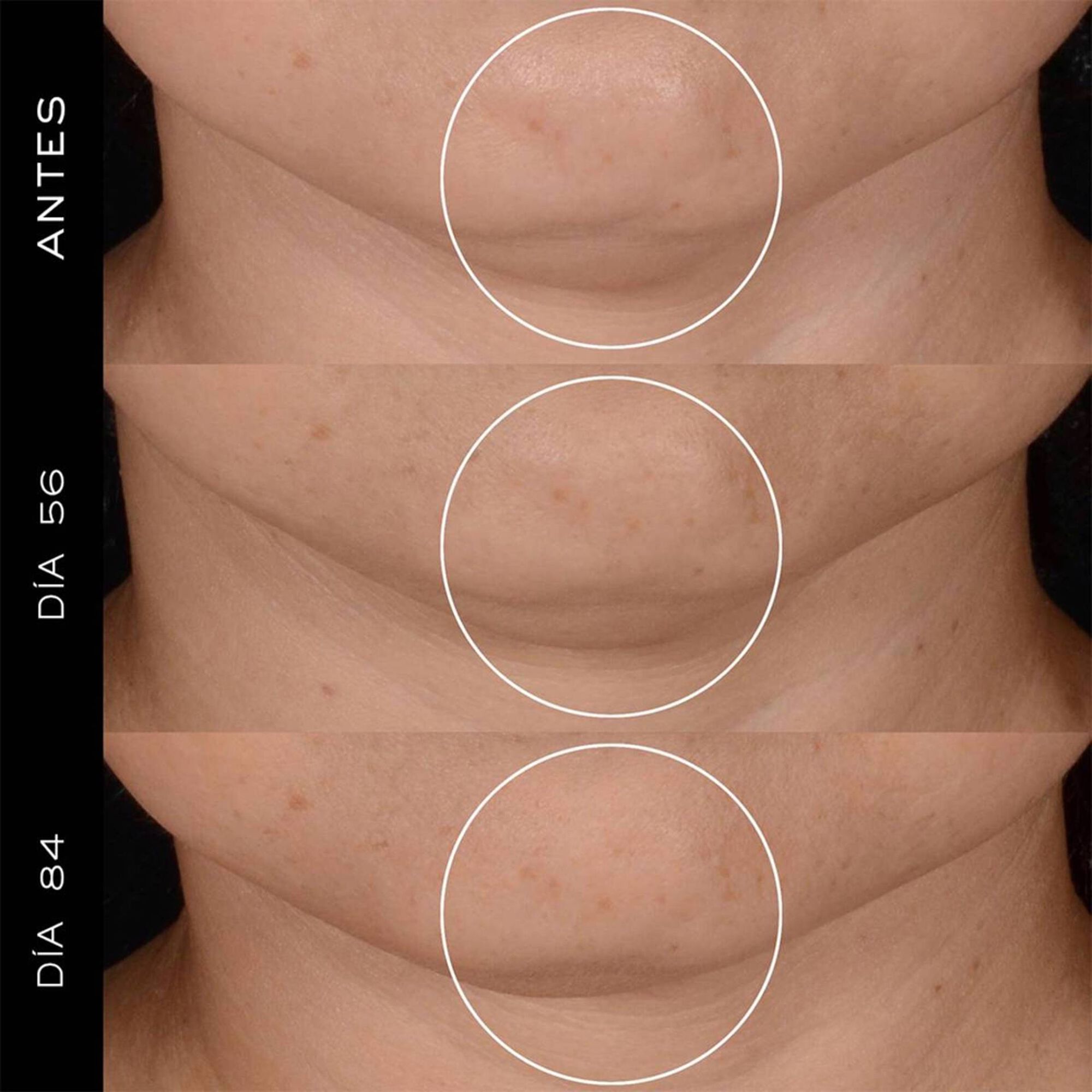 Rénergie H.P.N. 300-Peptide Cream Anti-Âge