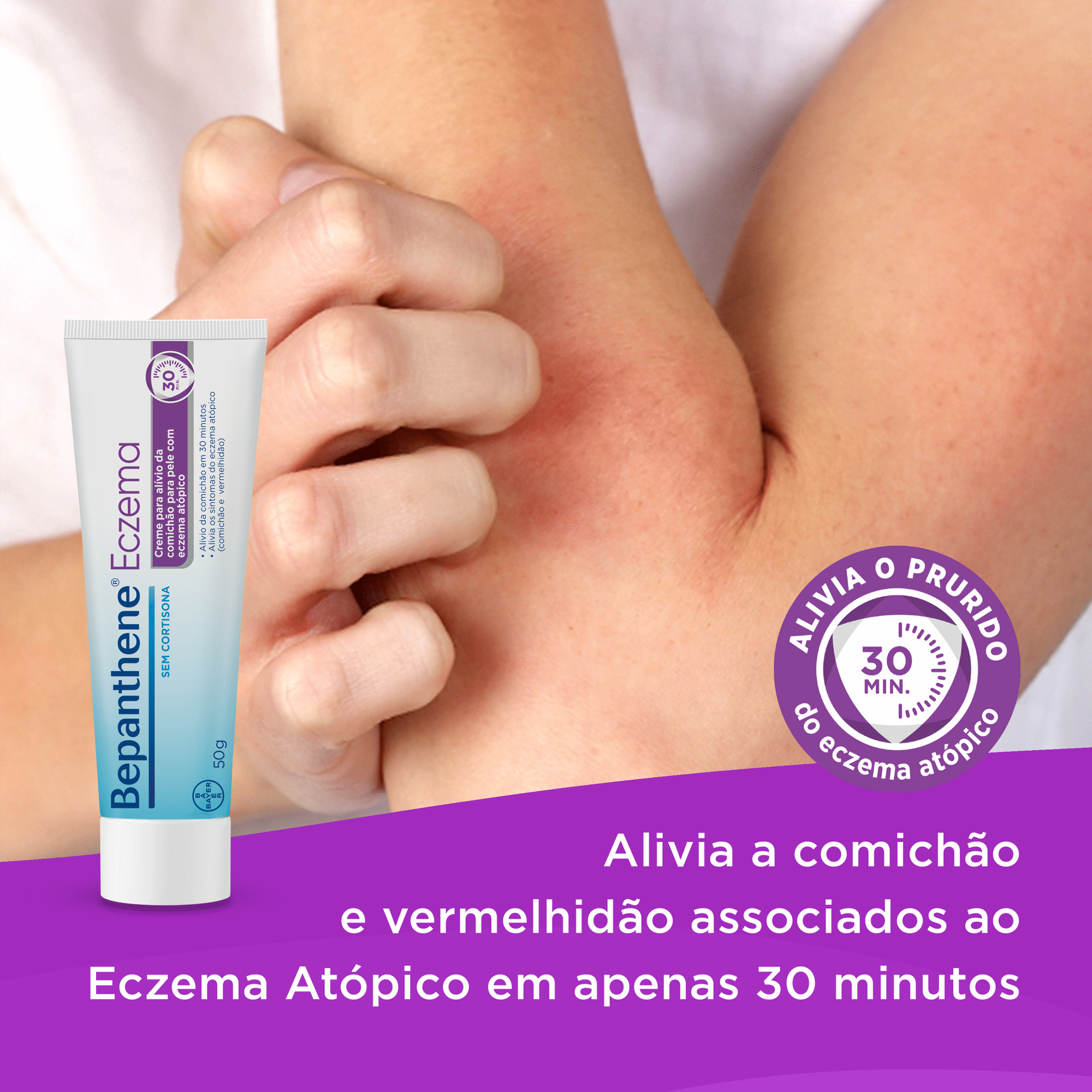 Creme Eczema Sem Cortisona