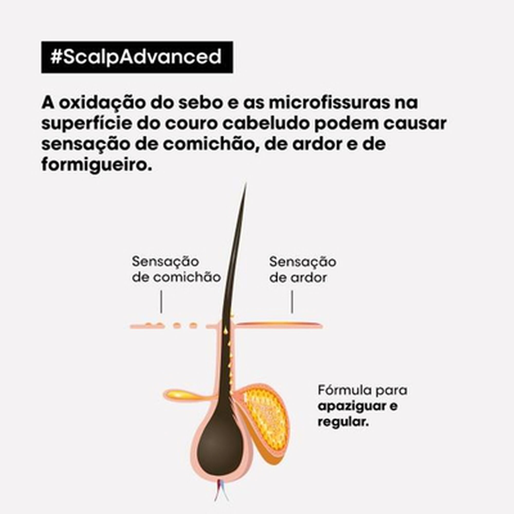 Serie Expert Scalp Advanced Inconfort Traitement