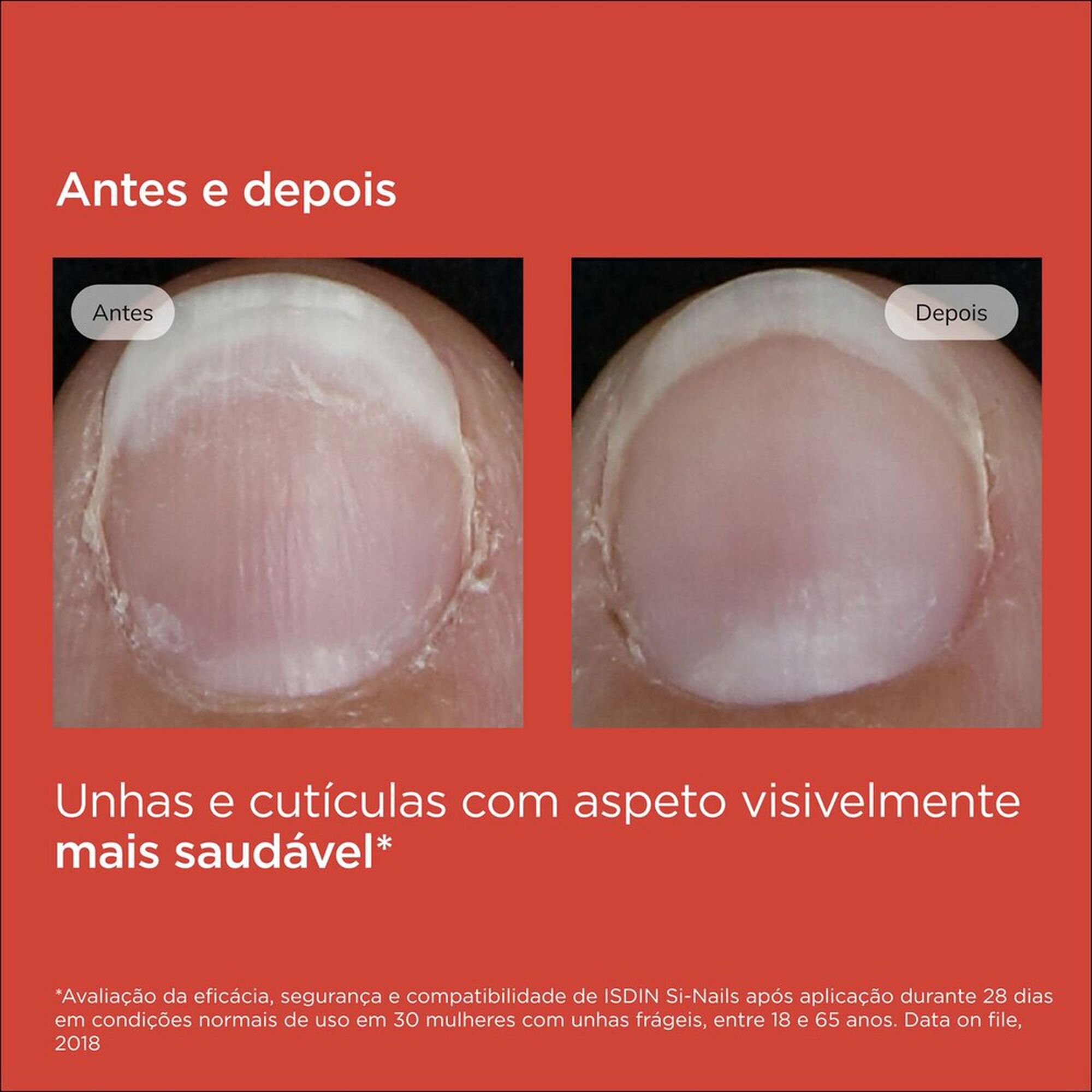 Si-Nails Verniz Fortalecedor De Unhas